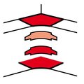 accessories-ducts-010658-legrand-1